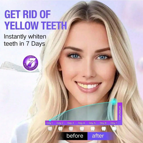 BrightSmile Whitening Strips